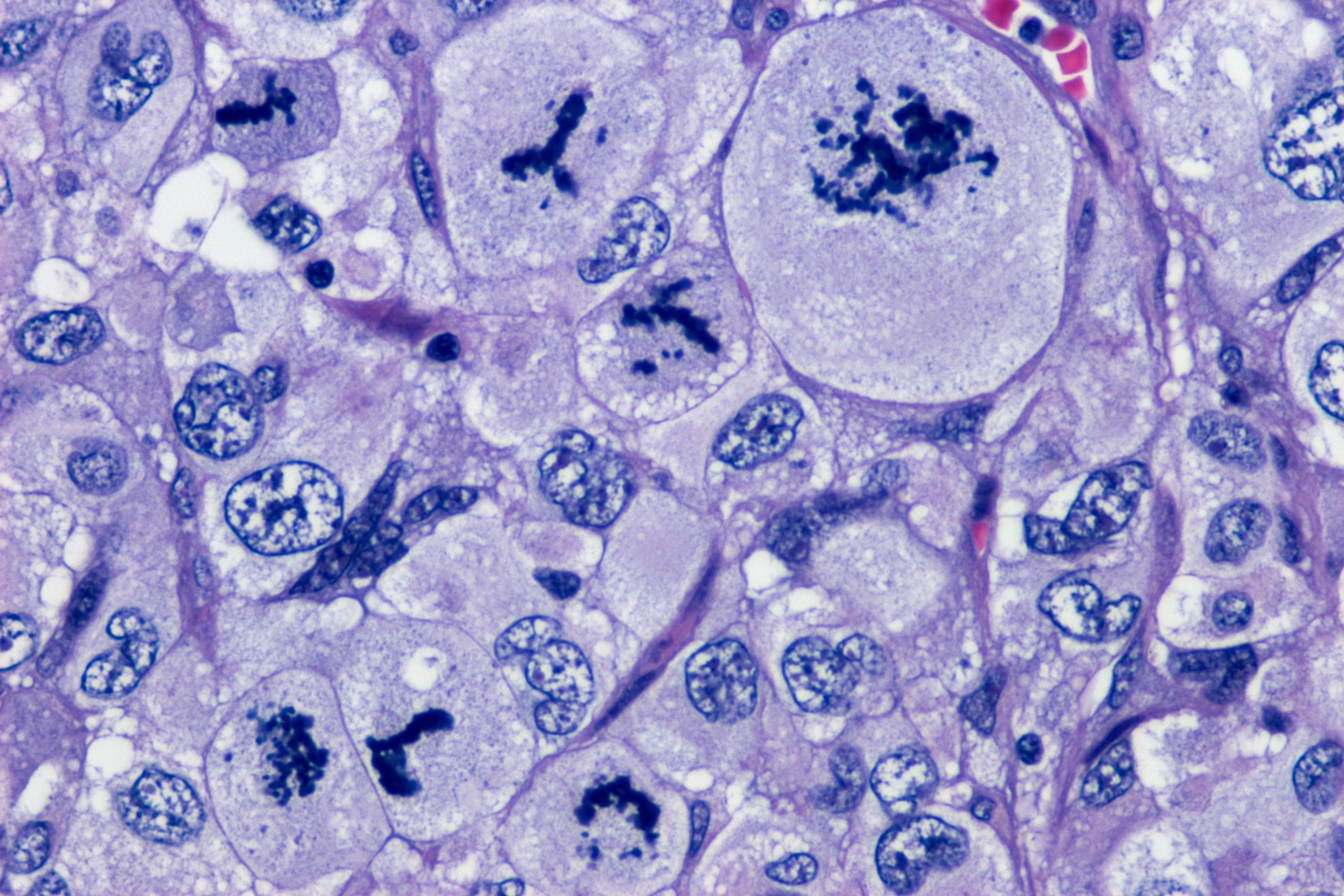 Marcelo Balancin cover image